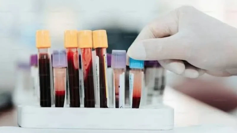Exame de sangue identifica 86,8% dos casos iniciais de câncer de pâncreas
