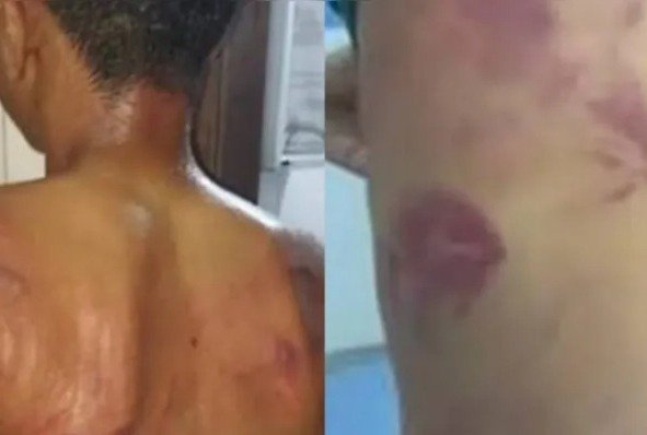 Pai é preso após espancar filho de 13 anos por usar brincos