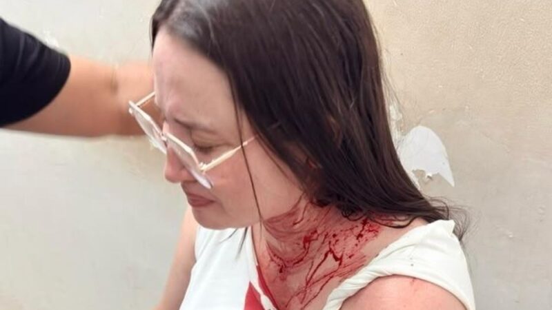 Candidata a deputada estadual pelo PSOL é atingida na cabeça por pedra durante caminhada