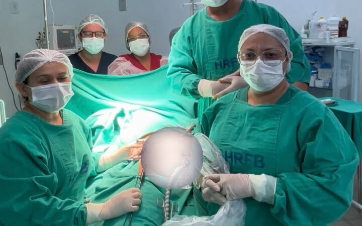 Hospital Regional Fernando Bezerra realiza sua primeira cirurgia por videolaparoscopia